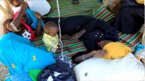 السودان يعلن وفاة 5 أشخاص بـ«الكوليرا» في ولاية النيل الأزرق