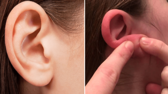 تعرف على أسباب الرائحة الكريهة خلف الأذن وكيفية علاجها